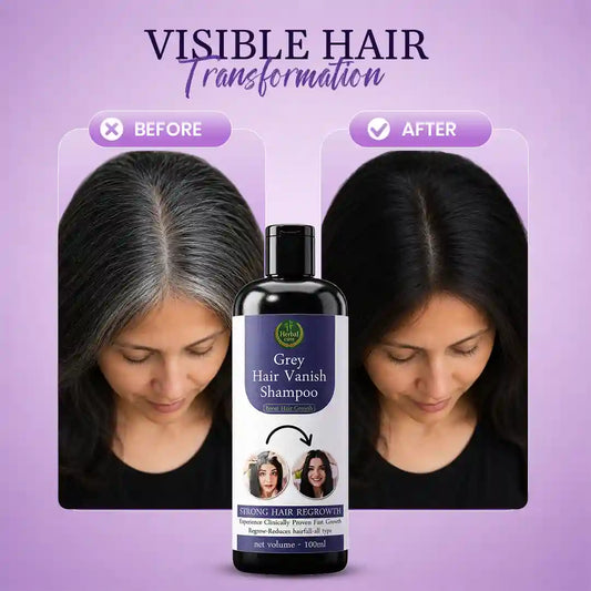 Grey Hair Vanish Shampoo Grey Hair Care & Stronger Hair ⭐