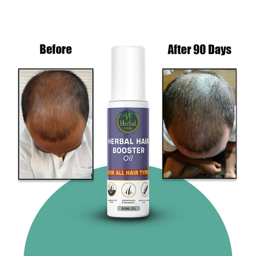 Herbal Hair Booster Oil-For Men and Women
