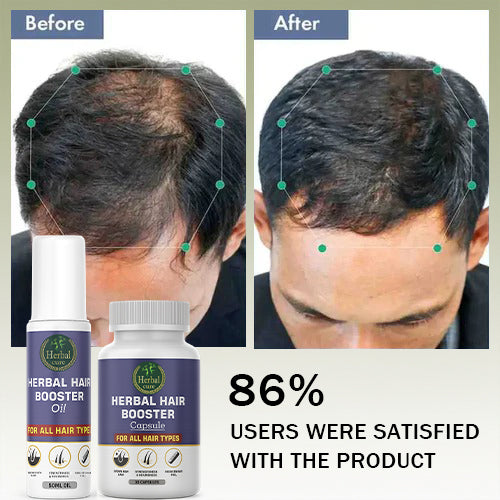 Before and after comparison of hair growth with Herbal Hair Booster 