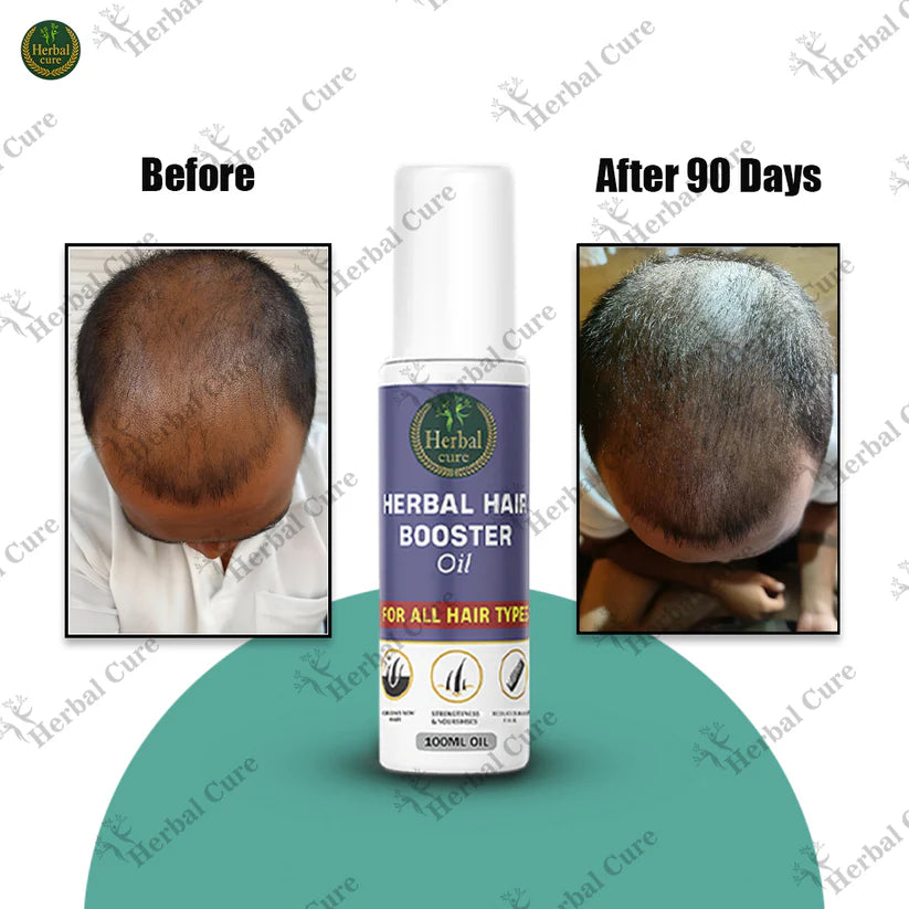 Herbal Hair Booster Oil-For Men and Women 100 ML Oil