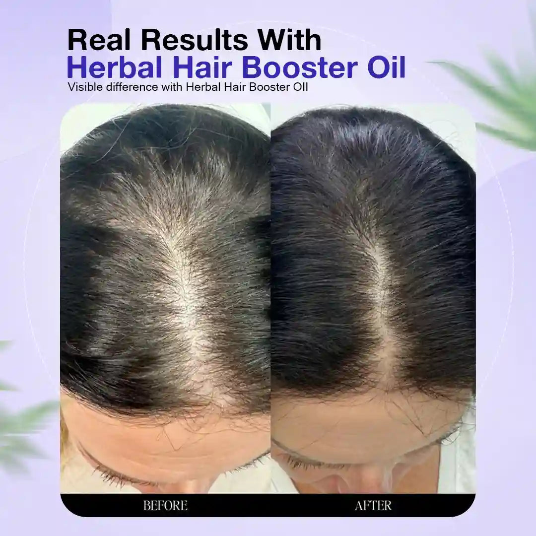 Herbal Hair Booster Oil-For Men and Women