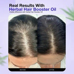 Herbal Hair Booster Oil-For Men and Women